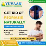 Psoriasis Treatment