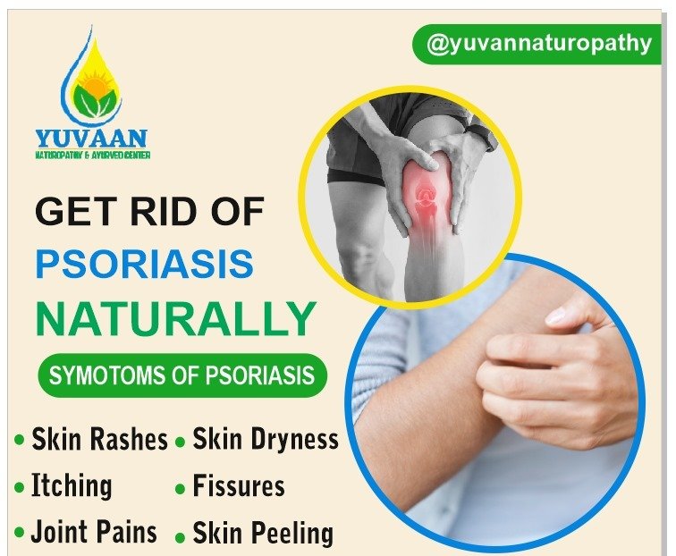 Skin Psoriasis - Yuvaan Nature Foundation